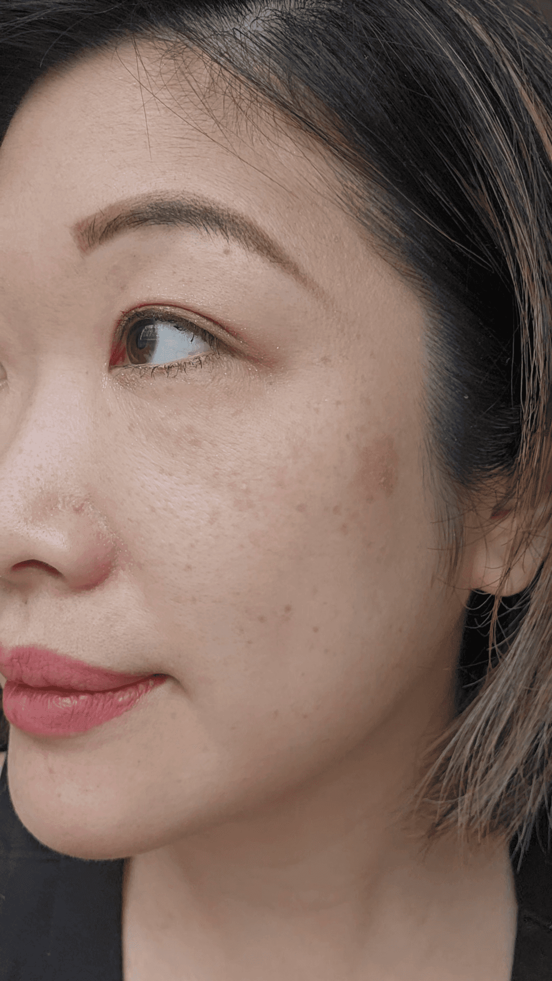 Macro photo of a large dark sunspot on the left cheek before targeted medical grade IPL pigmentation removal.